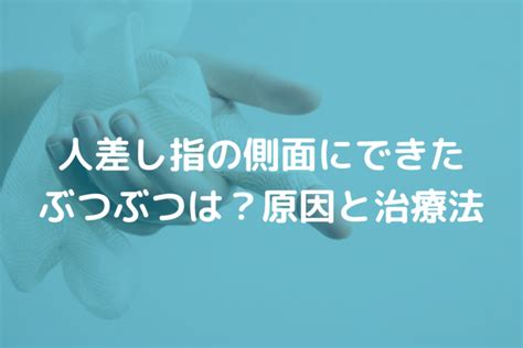 指穴|人差し指の側面にできたぶつぶつは？原因と治療法を。